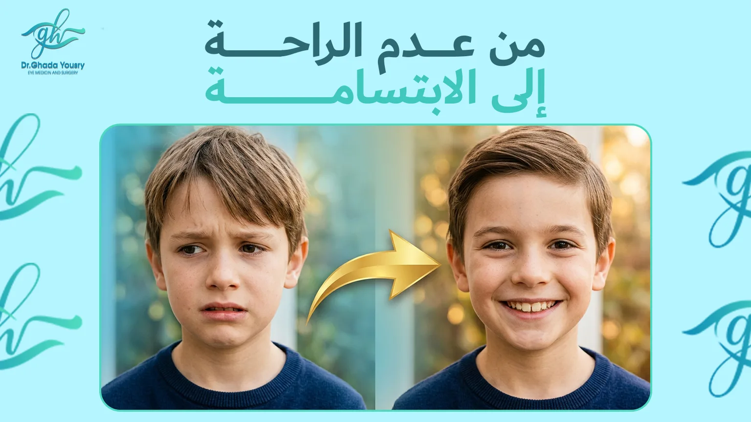 مقارنة بين محاذاة العين قبل عملية الحول وبعدها عند الأطفال
