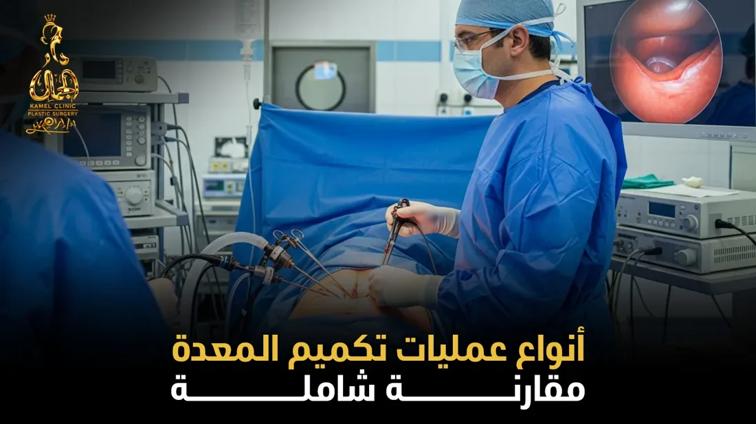 أنواع عمليات تكميم المعدة ومقارنة شاملة في مركز دار الجمال