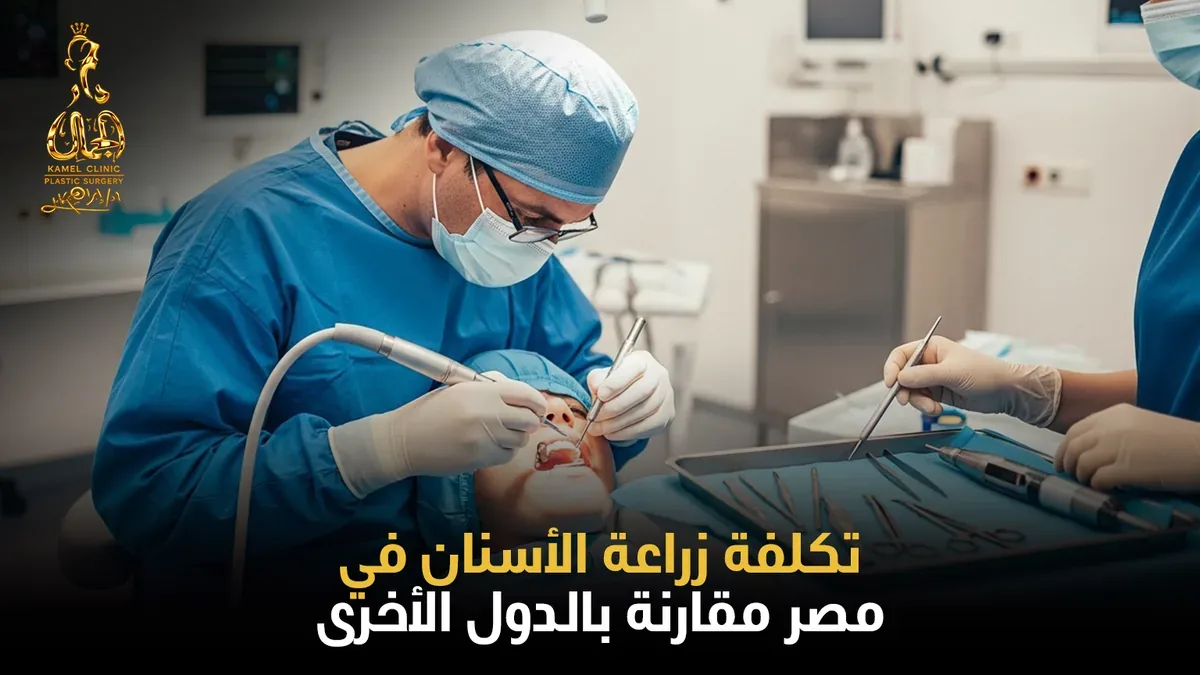 تكلفة زراعة الأسنان في مصر مقارنة بالدول الأخرى