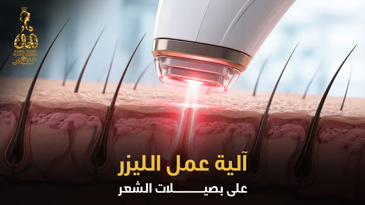 آلية عمل الليزر على بصيلات الشعر