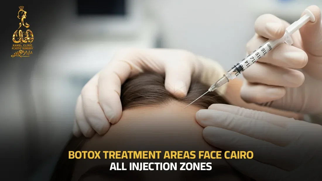 Botox treatment areas and facial injection zones in Cairo at Dar El Gamal