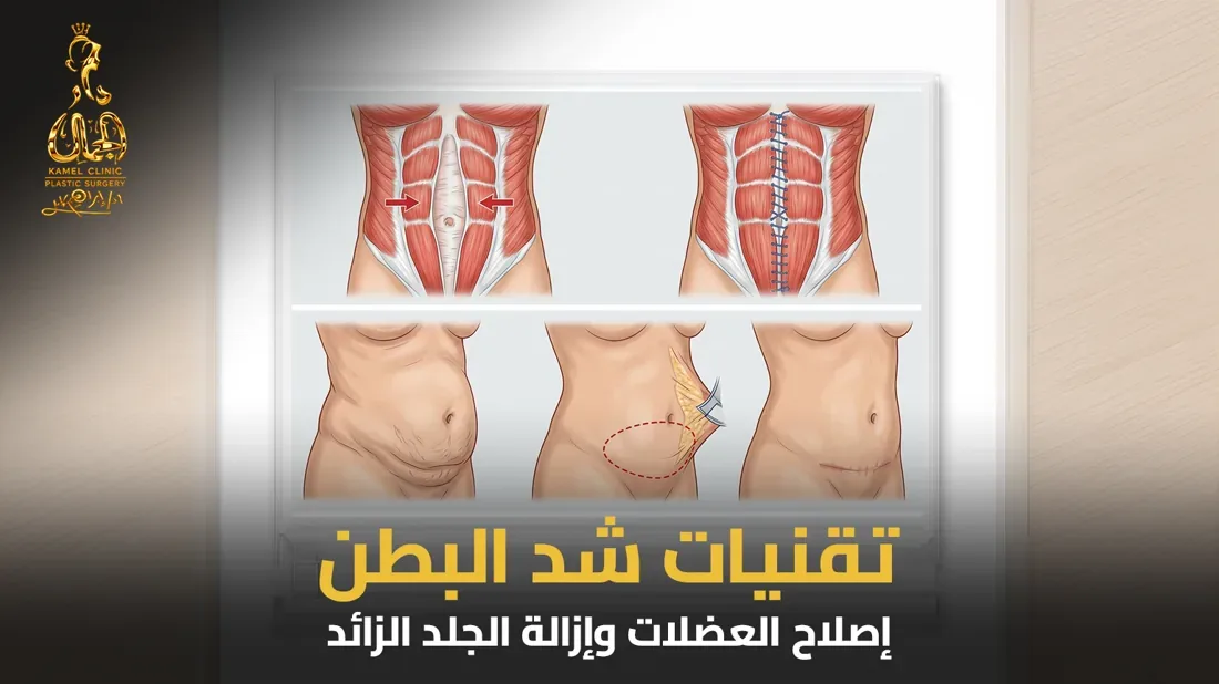 أنواع وتقنيات عملية شد البطن بعد الولادة القيصرية في مركز دار الجمال