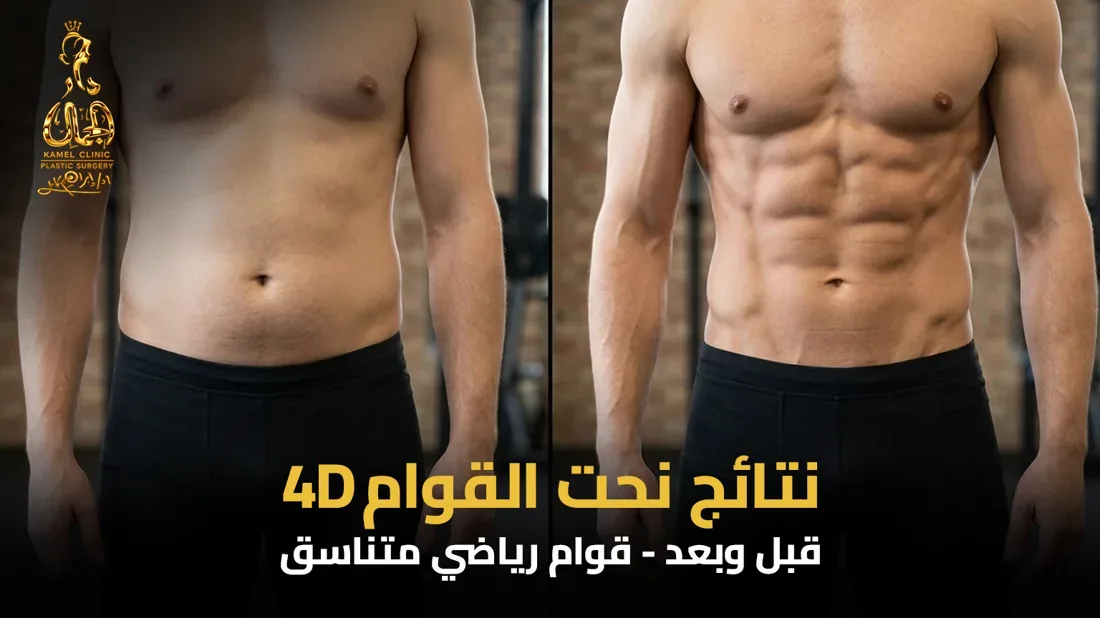نتائج نحت القوام رباعي الأبعاد 4D قبل وبعد في مركز دار الجمال