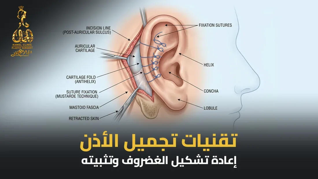 تقنيات عملية تجميل الأذن البارزة في مركز دار الجمال
